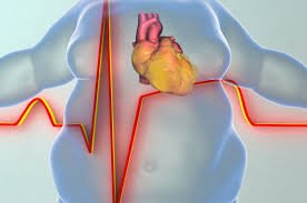 How to prevent Obesity to reduce cardiac arrest?